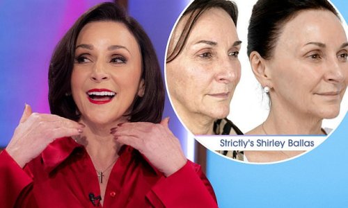 'Look at that jawline girls, I'm 63 this year!' Shirley Ballas says she is 'delighted' with results of her non- surgical face-lift to get rid of 'sagging skin, sun spots and veins'