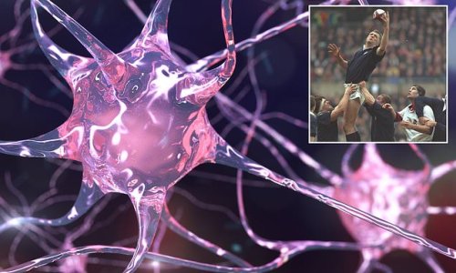 Exercise can increase the risk of motor neurone disease, experts warn