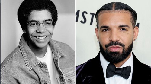 Did Drake get a nose job and a BBL? Plastic surgeons weigh in as rap feud with former friend Rick...