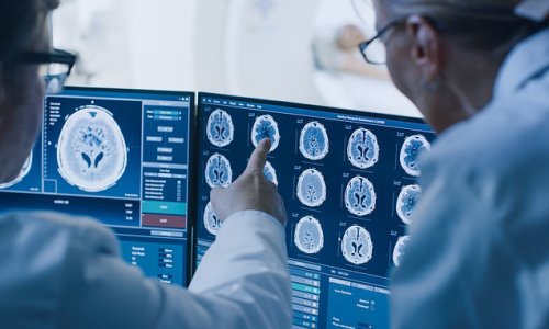Thousands of patients thought to be in a vegetative state are awake