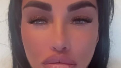 Katie Price shows off her 'natural lips' as she has her filler dissolved - before getting her pout redone in dramatic new 'Russian doll' style