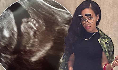 'It's a boy!' Pregnant Angela Simmons announces gender with ultrasound snap