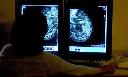 Breast cancer breakthrough: 'Game-changing' drug shrinks tumours and halts onslaught of disease