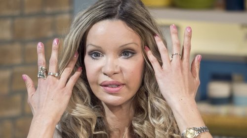 Alicia Douvall's incredible transformation: Glamour model who spent £1m on 400 plastic surgeries