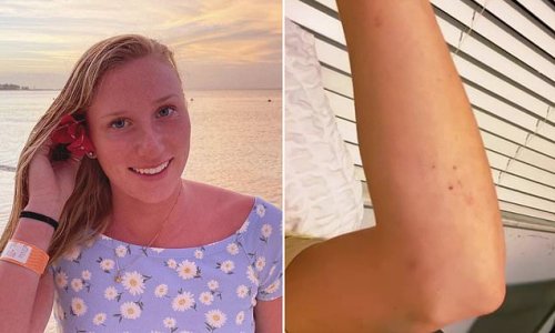Former basketball star, 20, finds out she has rare BLOOD CANCER after she goes to doctor for dots appearing on her skin
