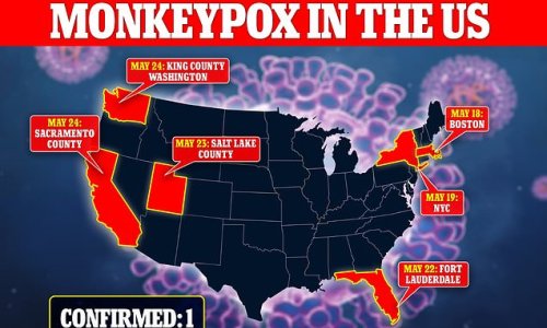 California reports 'likely' case of monkeypox virus - bringing America's tally to eight presumptive cases: Florida, NYC, Utah and Washington all suspect cases while a single infection is confirmed in the Boston