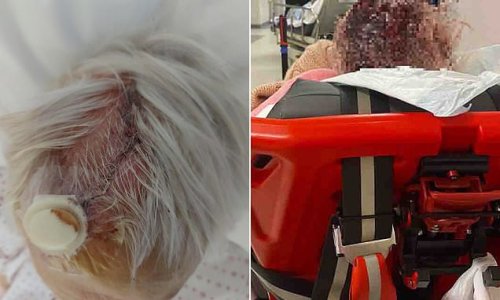 Grandmother, 90, with leukaemia was left in A&E corridor for 30 HOURS after splitting her head open in shocking sign of NHS crisis