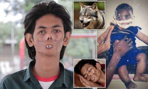 My face was eaten by a WOLF: Teen who was attacked and disfigured by predator as a baby is dubbed 'Ghost Boy' by cruel villagers in India