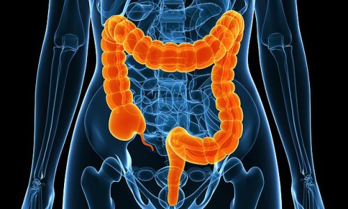 Once-a-day tablet can wipe out severe bowel disease ulcerative colitis in just three months