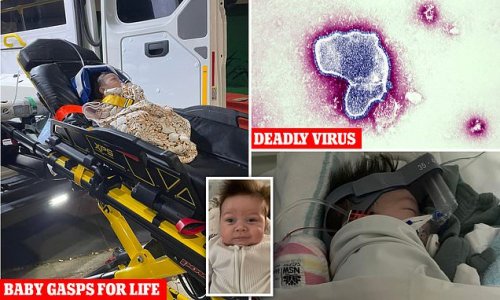 EXCLUSIVE: Baby almost dies 'gasping for air' after catching a deadly winter virus spreading fast in Australia after Covid lockdowns - as his mother issues a warning to parents