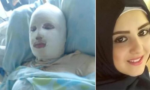Pregnant wife, 21, is left fighting for life with full body burns after enraged husband sets fire to her using a gas canister 'because she refused to have an abortion' in Lebanon