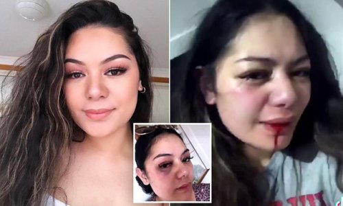 Young woman left shattered after Tik Tok DELETES her video about DV