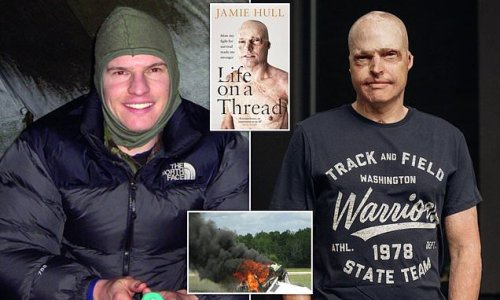 Soldier who suffered 63% burns in plane crash planned Dignitas trip