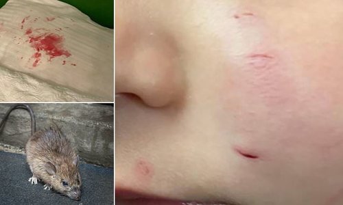 'Traumatised' mother walked in on 'horror movie' scene when she found a RAT biting her two-year-old son's face while he slept