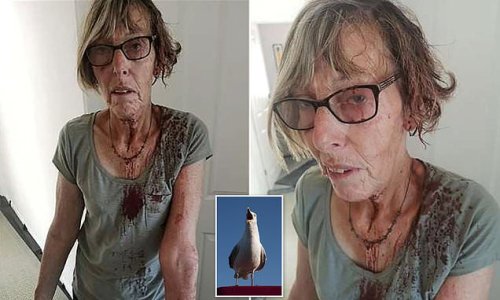 Crazed seagull attack leaves grandmother, bloodied and looking like 'something from a Freddy Kreuger film' as she walked home in Kent