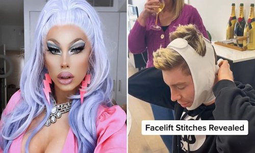 Drag queen hits back after cruel trolls attacked the 28-year-old for getting a facelift - but there was a reasonable explanation for the intense surgery: 'I have no regrets'
