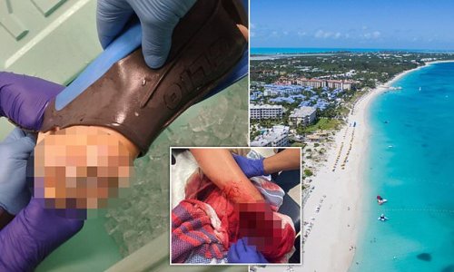 Yale graduate and marathon-runner, 22, has her FOOT bitten off by a shark while snorkeling off the coast of Turks and Caicos - and doctors couldn't reattach it after emergency plane took six hours to fly her back to Miami