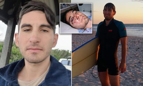 American student in Perth is left with horrific facial injuries after two teenagers on a moped threw a rock at him in a sickening unprovoked attack