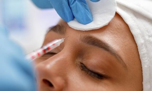 Botox 'may banish the blues': Wrinkle-busting jabs can alleviate symptoms of depression and anxiety simply by stopping you frowning, study suggests