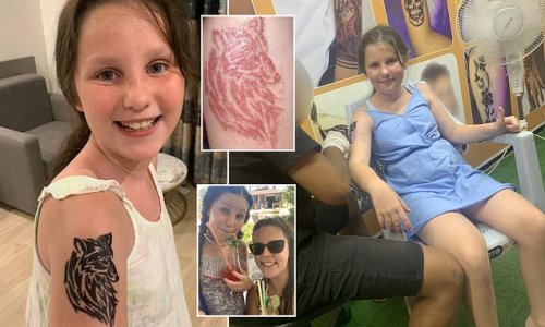 Schoolgirl, 10, could be left scarred after henna wolf tattoo she got on holiday to Turkey left her with CHEMICAL burns and her arm smelling of 'rotting flesh'