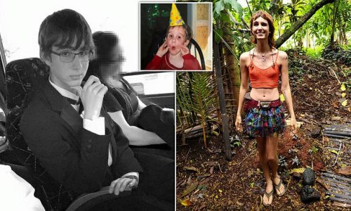 Intersex woman, 25, who was born with both male and female genitalia ...