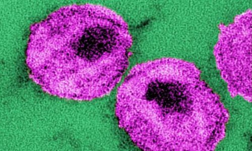 HIV eliminated in 40% of mice using a 'kick and kill' approach