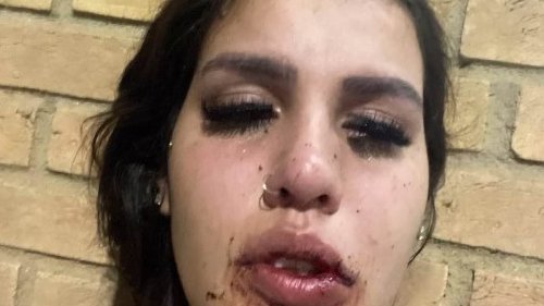 Instagram star is 'drugged, gang-raped and beaten by fellow influencers who invited her to a party':...