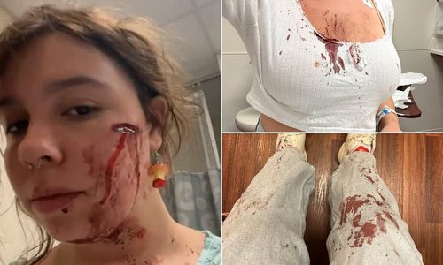 July Fourth victim shows her horrific facial injury after being grazed by bullet