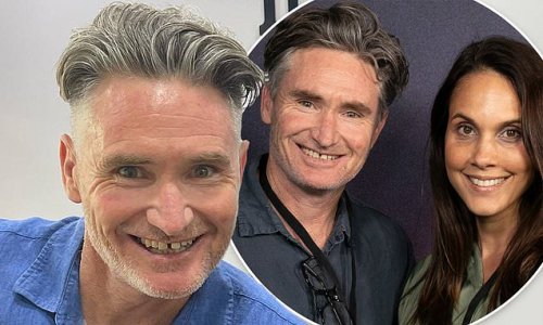 Dave Hughes reveals his wife threatened to stop having sex with him if he loses anymore teeth: 'They were falling out left, right and centre'