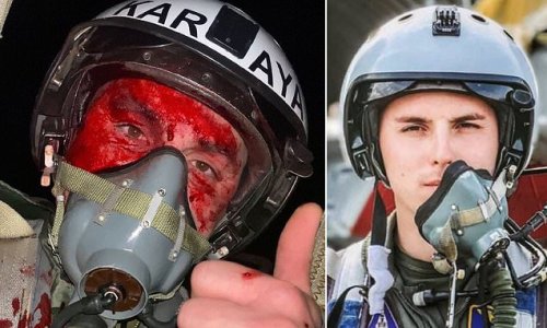 Ukrainian pilot snaps a selfie of his blood-covered face after ejecting having shot down wave of Russia’s Iranian-made suicide drones - before being given hero status by Zelensky