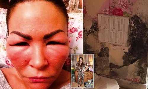 Woman says mould infestation in council flat 'caused severe reaction'