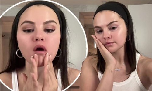 Selena Gomez says her hands 'shake' as a side-effect of her lupus medication after fans pointed out singer's 'unsteady' makeup application in new TikTok
