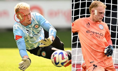 Tom Glover sports a plaster as Melbourne City goalkeeper returns to ...