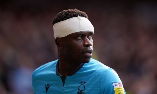 Brice Samba left with a gruesome head injury against Derby County.