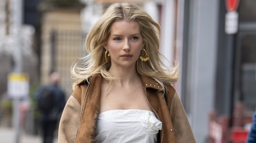 EXCLUSIVELottie Moss is glowing as she shows off her new natural look during a London outing after having jaw and lip filler dissolved and her tattoo removed