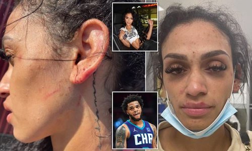 'I won't be silenced any more': Miles Bridges' wife posts gruesome images of injuries all over her body and says she was 'choked until I went to sleep' - a day after NBA star husband turned himself in on felony domestic violence charge