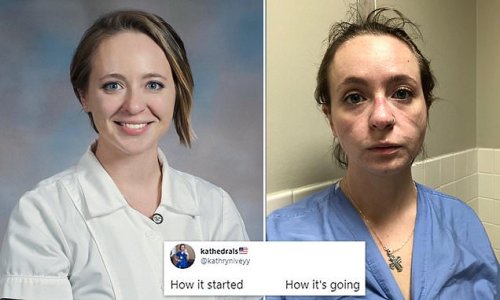 Nurse's heartbreaking before-and-after photos show the devastating toll the pandemic has taken on healthcare workers - as she urges people to protect themselves AND others