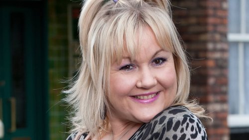 EXCLUSIVECoronation street actress reveals gruelling facial surgery after YEARS of unhappiness about a particular feature