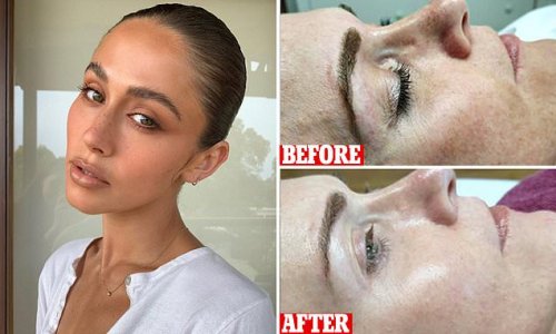 Best-selling 'miracle' serum has hundreds of five-star reviews from women claiming it calms down redness and soothes acne spots