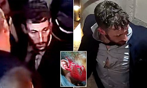Shocking images show horror injuries to nightclub worker's face after they were attacked by group on stag do to Cheltenham Races - as police issue CCTV of suspects