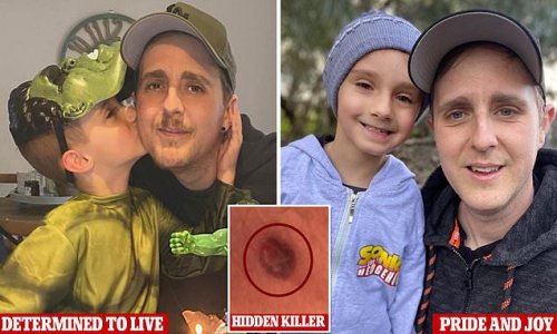 Single dad fighting stage 4 skin cancer reveals key area to check