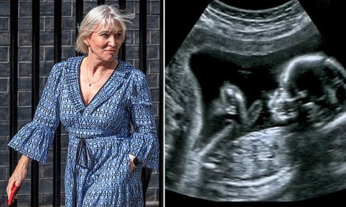 Ex-nurse Nadine Dorries calls for Britain’s abortion limit to be reduced by four weeks to 20 weeks – but insists the procedure should remain freely available