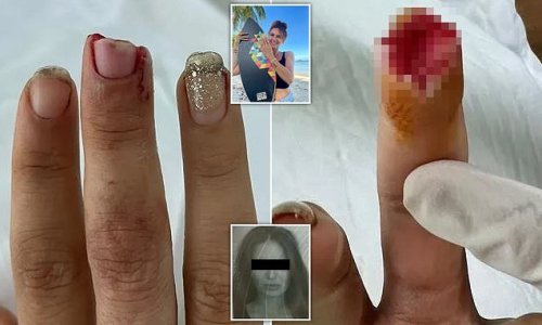 Female British tourist has part of her finger bitten off 'like something out of a horror movie' by Russian woman after argument broke out over a beanbag on a Thai beach