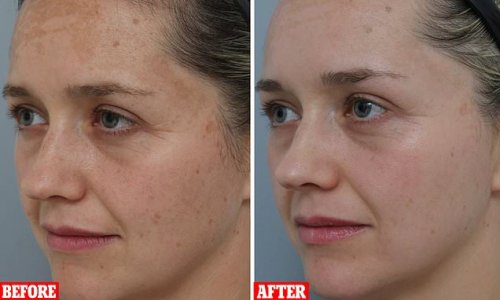 How new mum in her 30s transformed her tired, pigmented and ageing skin by swapping to ONE regime - and she's never had so many compliments