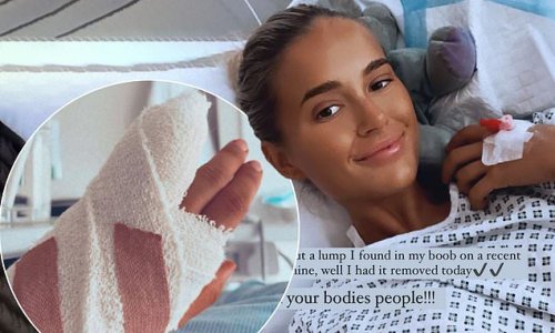 Molly-Mae Hague reveals she has had lumps in breast and finger removed