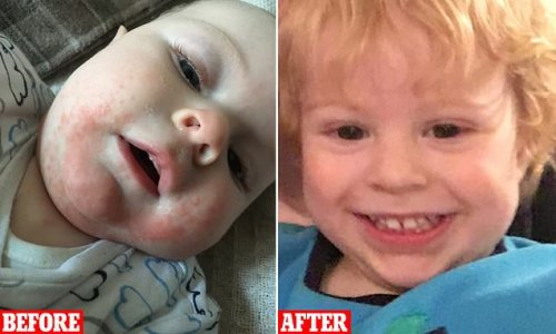 Mum reveals the 'game changing' $49 skincare that cleared up her little boy's severe eczema - after struggling to treat it for months