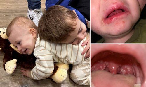 Parents of children who have battled Strep A warns parents to look out for THESE signs - including aches and tiredness, 'tickles in the throat' and struggling to pass urine