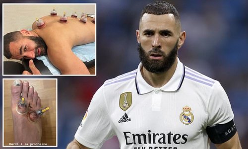'Thank you, until next time': Karim Benzema signs off for season - and maybe his time at Real Madrid - by posting picture of treatment on gruesome foot injury... with 35-year-old mulling over £173m Saudi offer