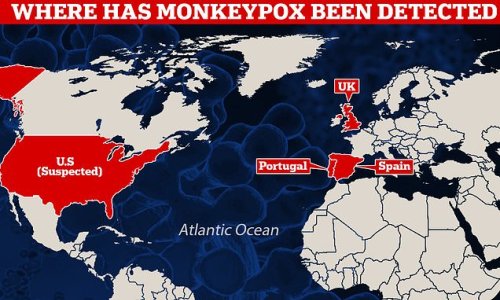 CDC raises alarm over monkeypox outbreak after SIX Americans were potentially exposed to virus after sharing flight with UK patient - Nearly two dozen potential cases of rare virus found in Europe