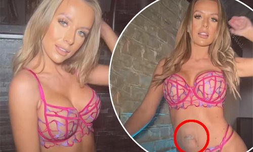 Faye Winter unveils results of mole removal from her stomach